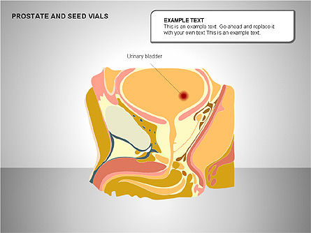Diagrama das vesículas seminais e prostáticas, Deslizar 2, 00222, Diagramas e Gráficos Médicos — PoweredTemplate.com