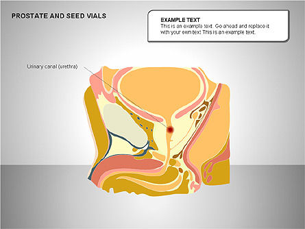 Diagrama de las vesículas prostáticas y seminales, Diapositiva 4, 00222, Diagramas y gráficos médicos — PoweredTemplate.com