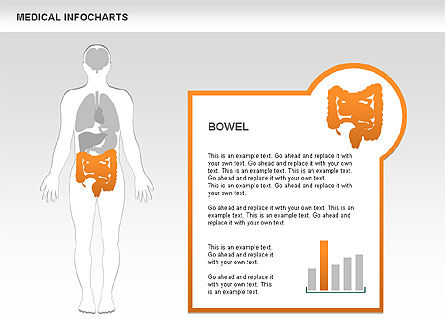 Cuadros Médicos, Diapositiva 7, 00460, Diagramas y gráficos médicos — PoweredTemplate.com