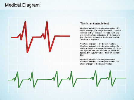 의료용 도형, 슬라이드 7, 01165, 의학 도표 및 차트 — PoweredTemplate.com