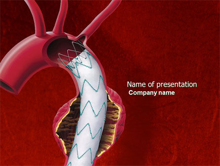 Aortic Aneurysm PowerPoint Template, 04202, Medical — PoweredTemplate.com