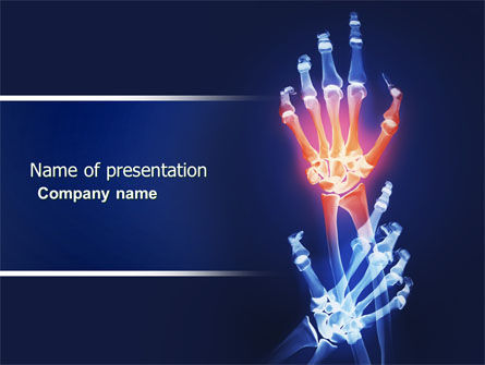 Modèle PowerPoint de arthrite, Modele PowerPoint, 04273, Médical — PoweredTemplate.com