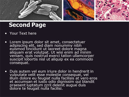 Tuberculose PowerPoint Template, Dia 2, 05171, Medisch — PoweredTemplate.com