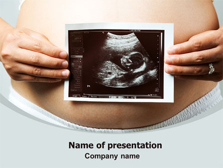 婴儿的超声波肖像PowerPoint模板, PowerPoint模板, 07501, 医药 — PoweredTemplate.com