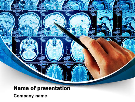 Brain Mri-scan PowerPoint Template, PowerPoint-sjabloon, 08061, Medisch — PoweredTemplate.com