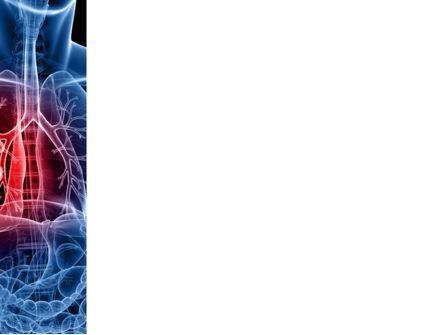 肺癌 - PowerPointテンプレート, スライド 3, 08239, 医療 — PoweredTemplate.com