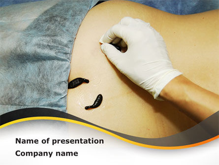 Leeches Therapy PowerPoint Template, Free PowerPoint Template, 09142, Medical — PoweredTemplate.com