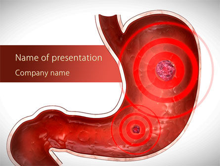 Plantilla de PowerPoint - dolor de estómago, Gratis Plantilla de PowerPoint, 09200, Médico — PoweredTemplate.com