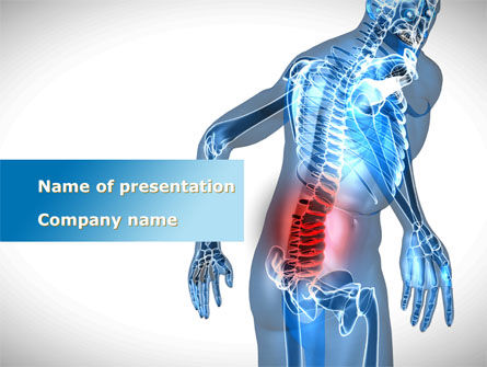 Lumbar Spine PowerPoint Template, 10035, Medical — PoweredTemplate.com