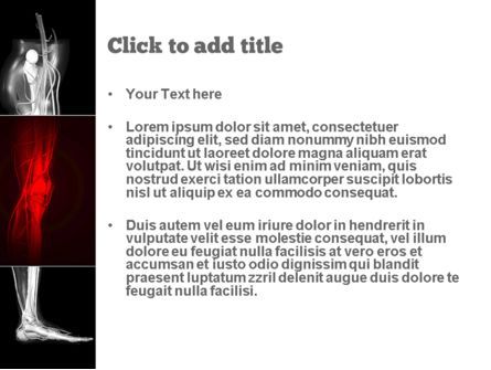 Templat PowerPoint Lutut Manusia, Slide 3, 11000, Medis — PoweredTemplate.com