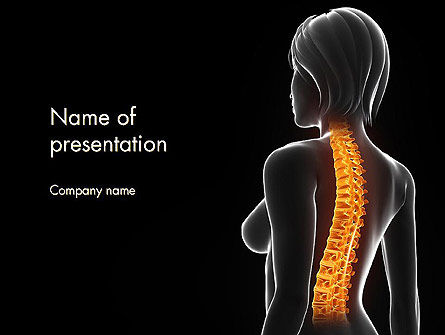 Female Spine Anatomy PowerPoint Template, PowerPoint Template, 14201, Medical — PoweredTemplate.com